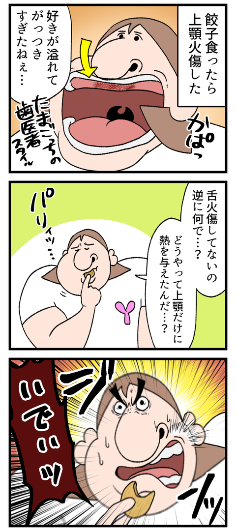 口内火傷は最悪です