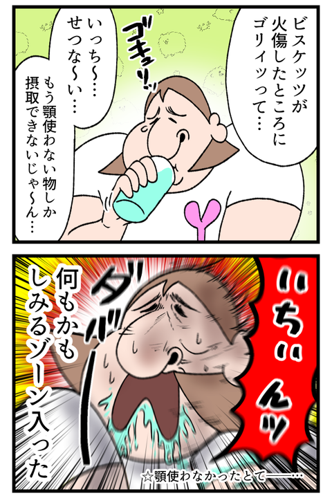 口内火傷は最悪です2