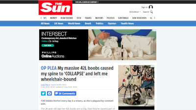 イギリス 巨乳 手術に関連した画像-02