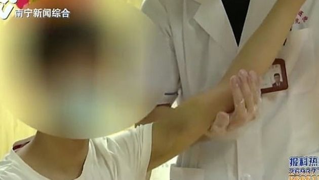 中国 ゲーム 脳卒中に関連した画像-03