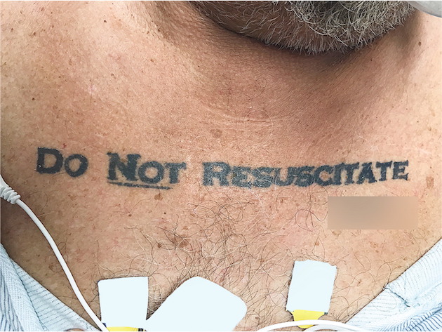 蘇生処置は行うな(DO NOT RESUSCITATE)に関連した画像-02