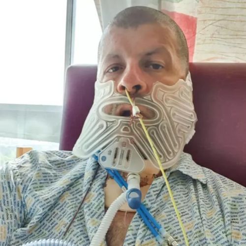歯医者 腫瘍 手術に関連した画像-03