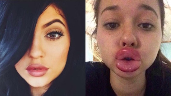 カイリー・ジェンナー・チャレンジ #KylieJennerChallengeに関連した画像-01