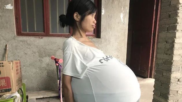 中国 奇病