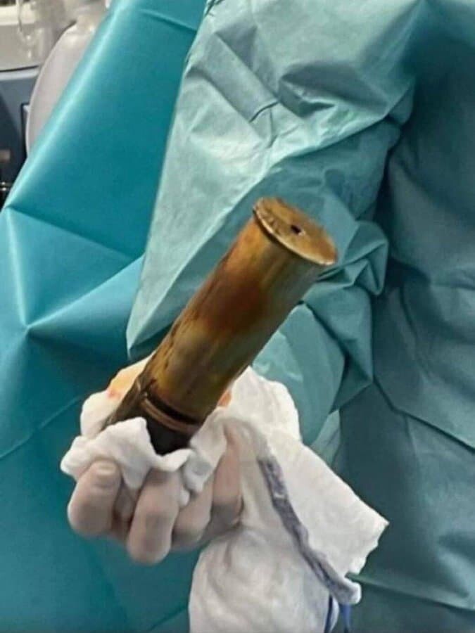フランス 砲弾 尻 お尻