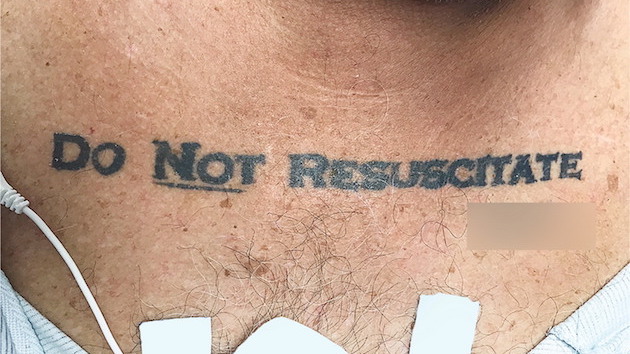 蘇生処置は行うな(DO NOT RESUSCITATE)に関連した画像-01