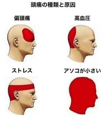 チビ悲報 背が低い人ほど攻撃的であることが科学的に立証される その理由があまりにもカワイソウ ユルクヤル 外国人から見た世界 チビ悲報 背が低い人ほど攻撃的であることが科学的に立証される その理由があまりにもカワイソウ ユルクヤル 外国人から見た世界