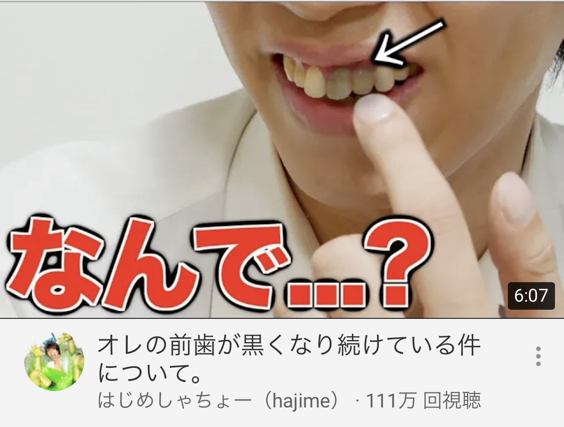 カリスマyoutuberさん 歯の神経が死ぬ Youtubercuration カリスマyoutuberさん 歯の神経が死ぬ Youtubercuration