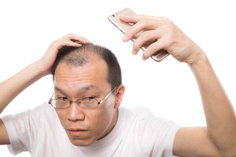 なんj若ハゲ部 ワイ 22 のハゲた前髪見てくれ 画像 薄毛速報 なんj若ハゲ部 ワイ 22 のハゲた前髪見てくれ 画像 薄毛速報