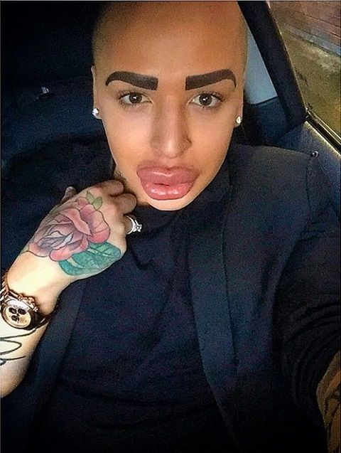 17