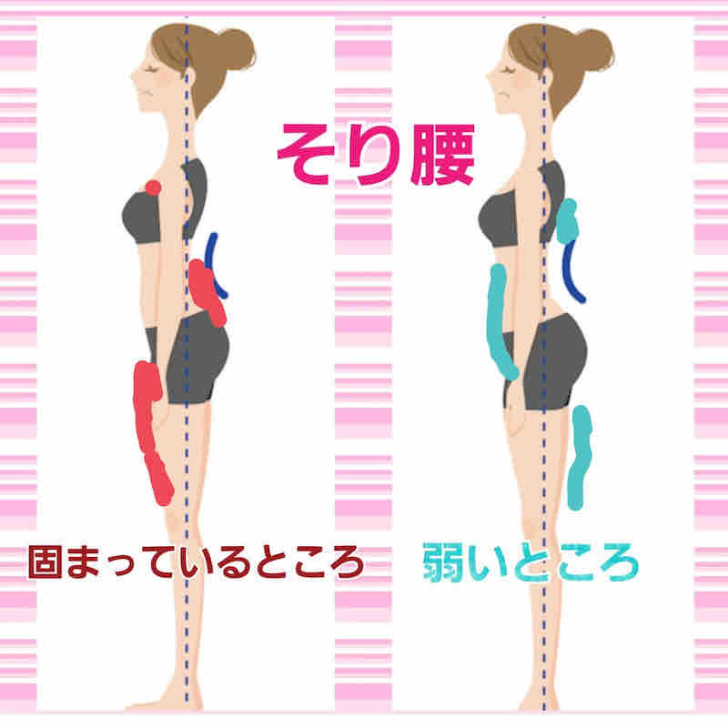 姿勢について 骨盤前傾 反り腰の解決法は簡単だった 日々の軌跡 今