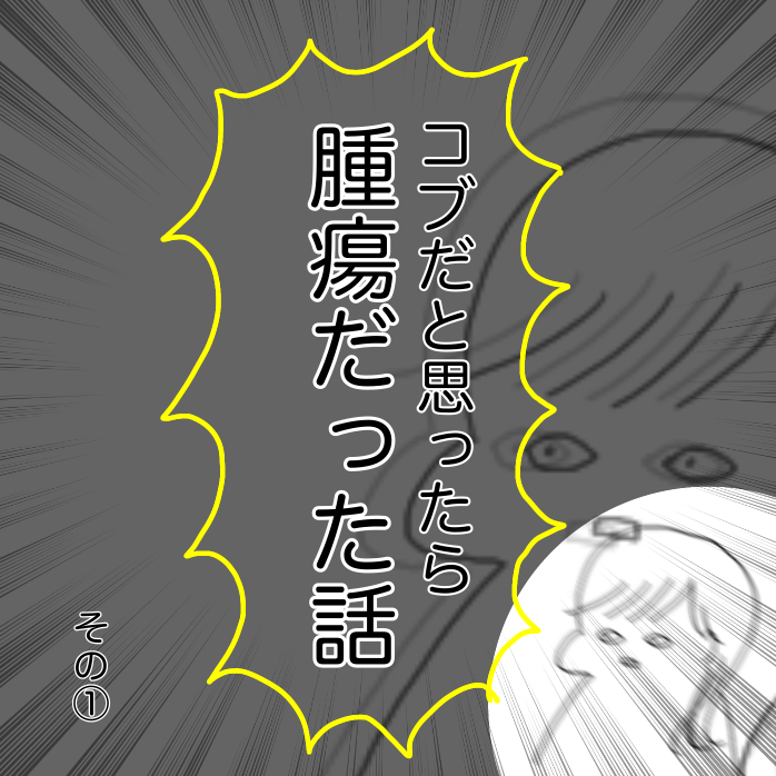 顎下腺腫瘍摘出した話 : ペタペタホニャララ