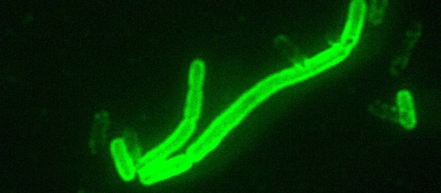 ヨーロッパで2人に1人が死亡したとされるペスト、発生源を特定か