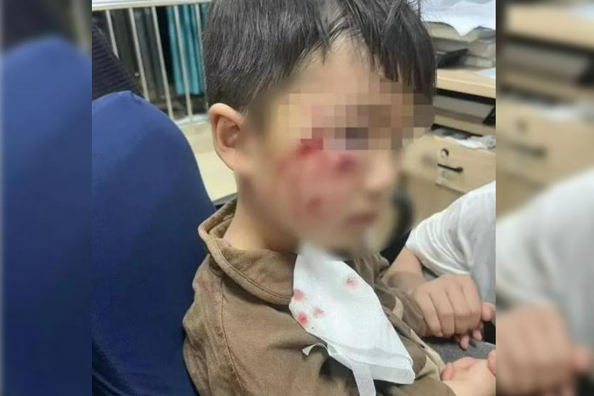 中国の3歳時、狂犬病で死亡？現地では25年間死亡例なし