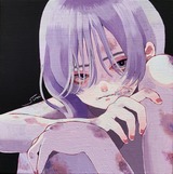 痣