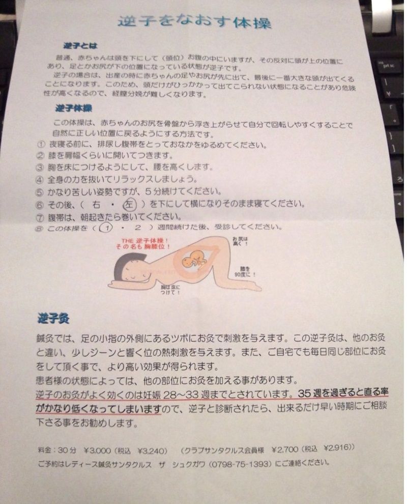 お腹の子が逆子だそうです というわけで 逆子体操始めました ザッタリー お腹の子が逆子だそうです というわけで 逆子体操始めました ザッタリー