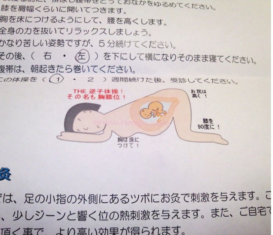 お腹の子が逆子だそうです というわけで 逆子体操始めました ザッタリー お腹の子が逆子だそうです というわけで 逆子体操始めました ザッタリー
