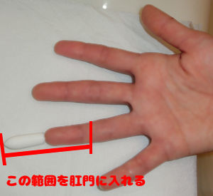 座薬の入れ方 コツ 痔とたたかうブログ 座薬 注入軟膏の入れ方 コツ