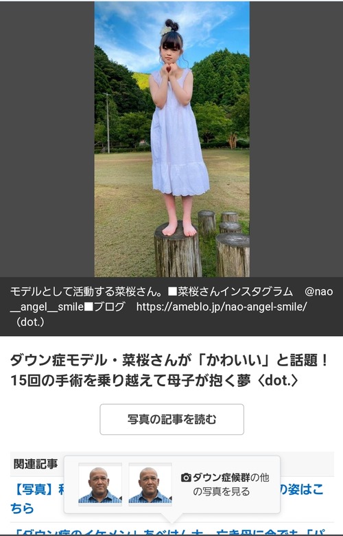 ダウン症さん 15回も手術し無事モデルになる Zチャンネル Vip 記事コメント 1 ダウン症さん 15回も手術し無事モデルになる Zチャンネル Vip 記事コメント 1