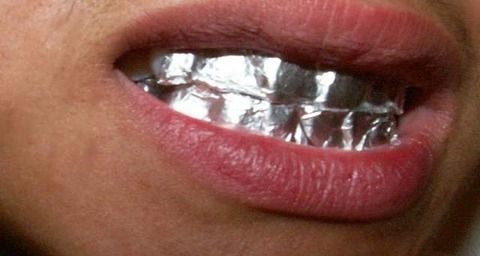 アルミ箔を使って歯を白くする方法とは Zeiwo アルミ箔を使って歯を白くする方法とは Zeiwo