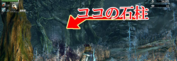 Bloodborne_kiniki_d5