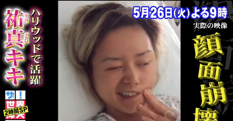 祐真キキ顔面麻痺 原因 (5)