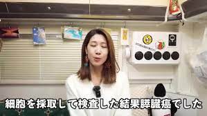 サニージャーニーみずきすい臓がんステージ4は嘘 (4)
