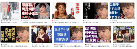 森公美子が両足切断の車いす (2)