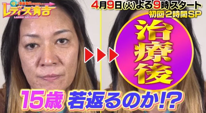 ジャガー横田息子受験結果の進学はどこ 顔の歪みの若返り手術結果を公開 画像 独女ちゃんねる