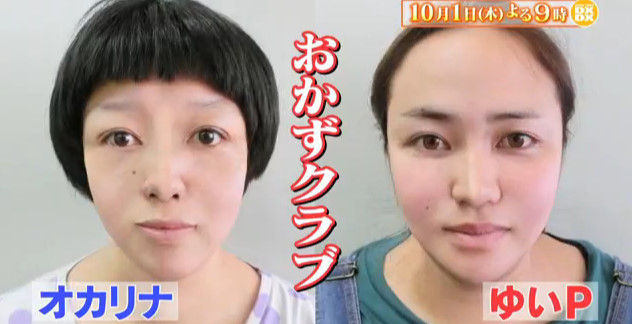 おかずクラブの整形後の顔が完全に別人ｗｗｗｗ ダウンタウンdx 画像 独女ちゃんねる