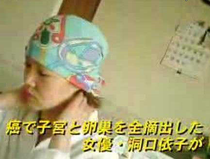 洞口依子リンパ浮腫 (6)