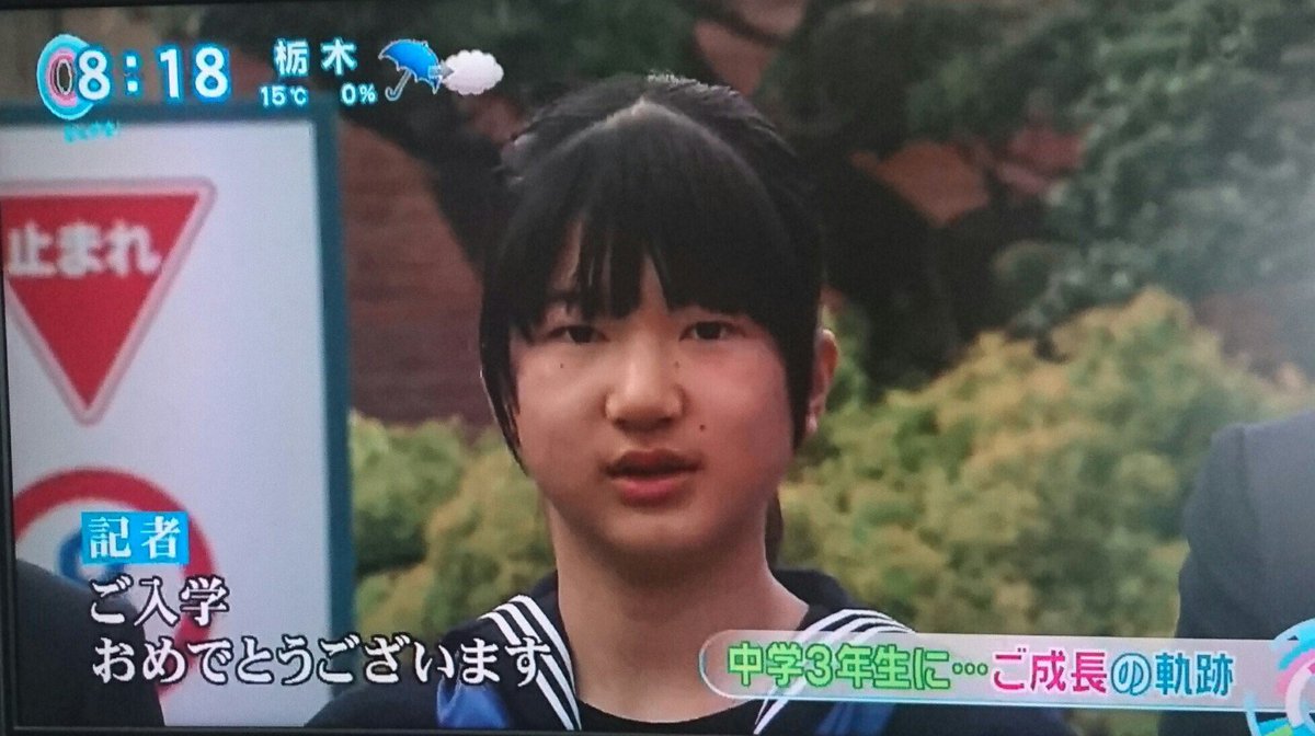 愛子さま激やせは障害を週刊文春が公表 画像 独女ちゃんねる 愛子さま激やせは障害を週刊文春が公表 画像 独女ちゃんねる