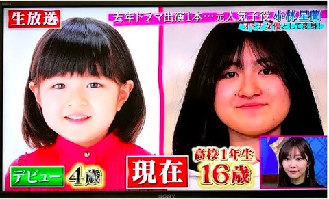 小林星蘭アザ顔写真 (4)