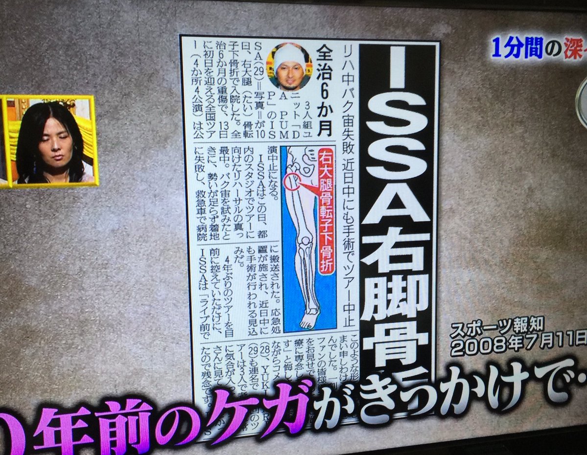 Issa 紅白舞台裏 足の激痛動画あり ネットの声は