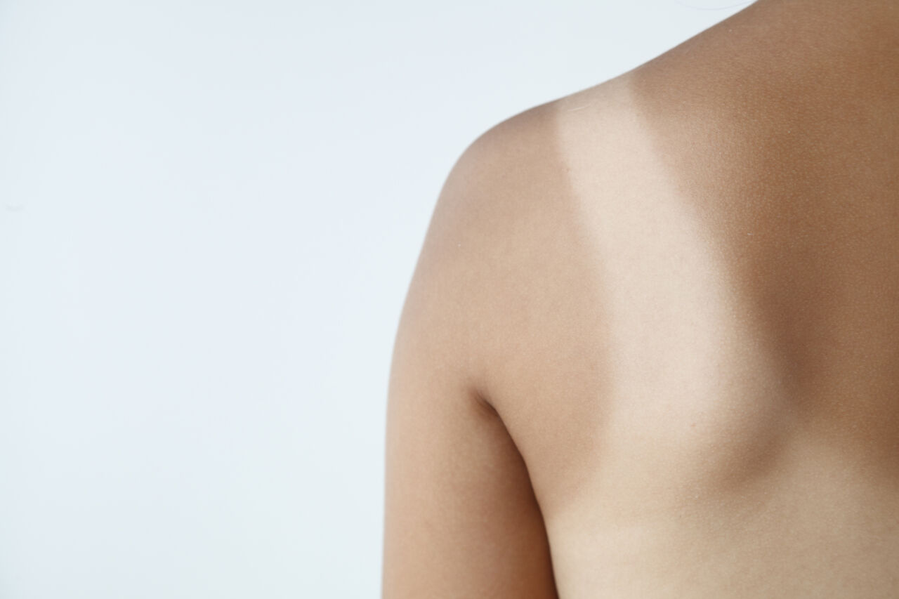 【画像】エッチな日焼け跡ｗｗｗｗｗｗｗｗｗ