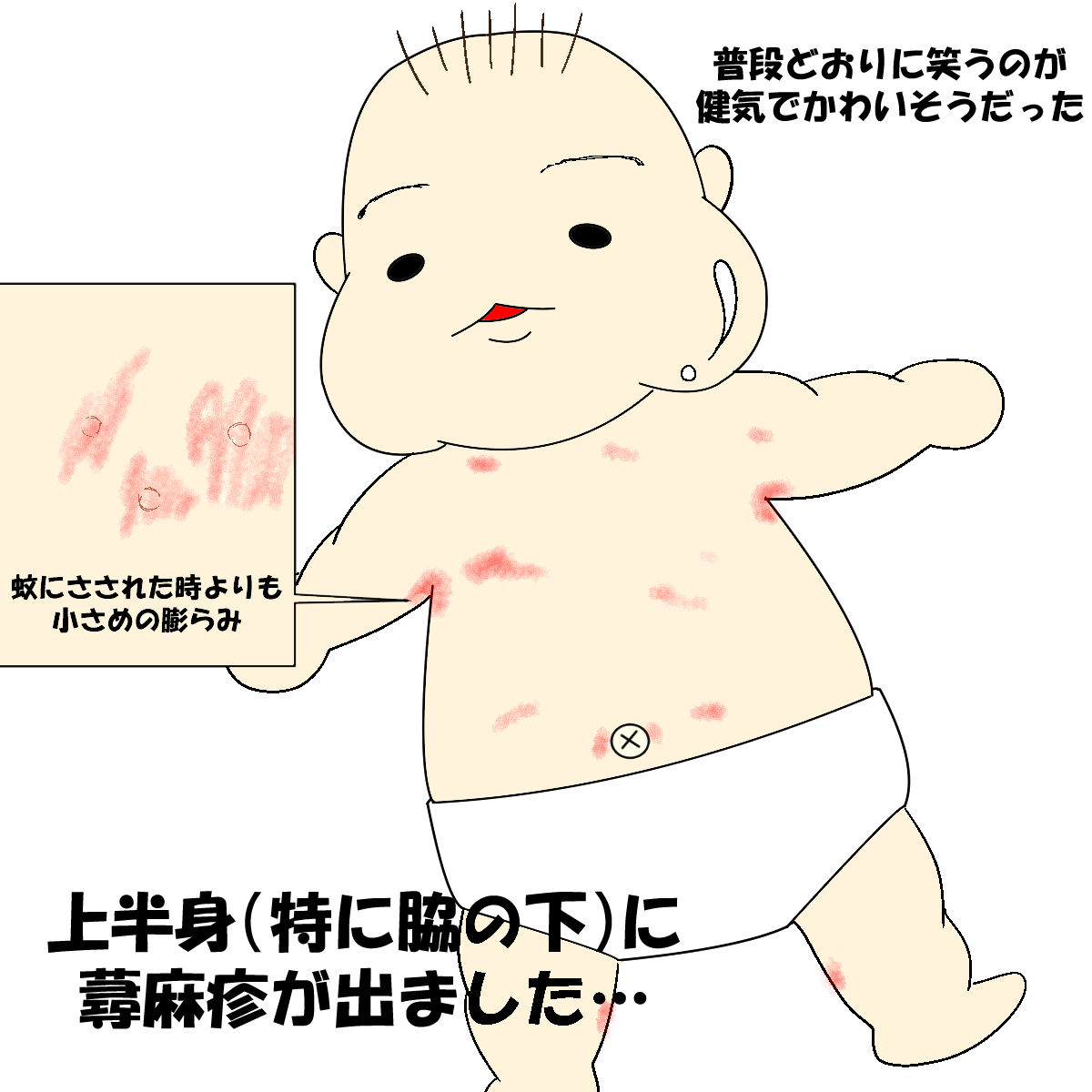 赤ちゃんの蕁麻疹の原因を調べてもらおうと思ったら 散々な目に遭いました ぷーやへささげるeveryday 赤ちゃんの蕁麻疹の原因を調べてもらおうと思ったら 散々な目に遭いました ぷーやへささげるeveryday
