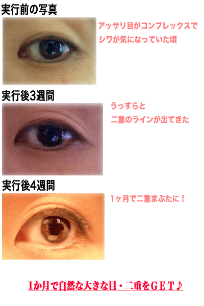 二重まぶた自力でなる 二重まぶたに自力でなる方法 二重まぶた自力でなる 二重まぶたに自力でなる方法