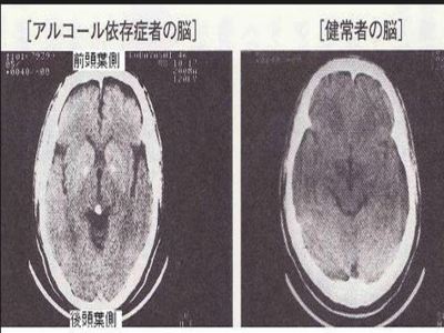FUoC1TGfNwctiFF1379766837_1379766847