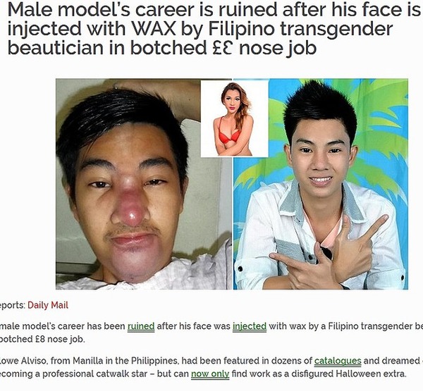 4c82b_196_31d4f20a_422758d9