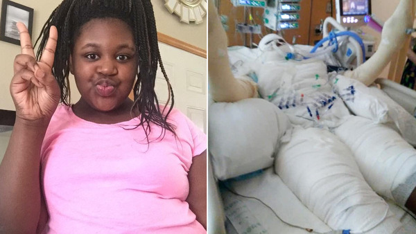 082118-firechallenge-