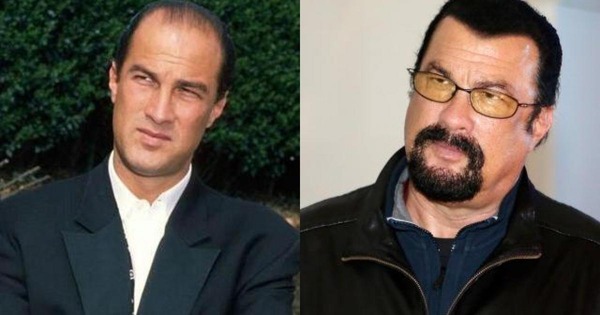 cheveux-chauve-steven-seagal