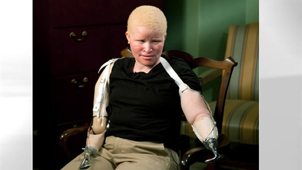 abc_staford_120228_wmain